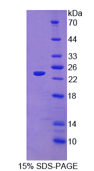 Recombinant Twisted Gastrulation Protein Homolog 1 (TWSG1)