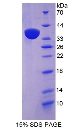 Recombinant Nesprin 2 (Nesp2)