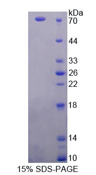 Recombinant Protoporphyrinogen Oxidase (PPOX)