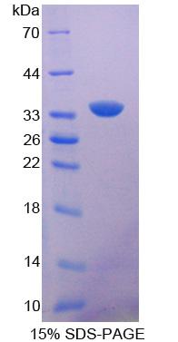 Recombinant Protoporphyrinogen Oxidase (PPOX)