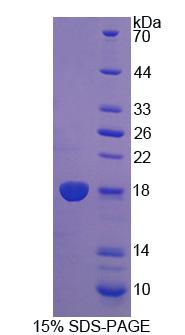 Recombinant Dual Specificity Phosphatase 5 (DUSP5)