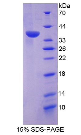 Recombinant Dual Specificity Phosphatase 6 (DUSP6)