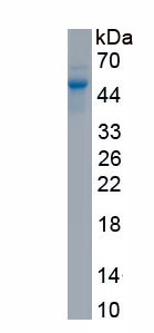 Recombinant Reticulon 4 Receptor (RTN4R)