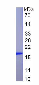 Recombinant Adenosine A2b Receptor (ADORA2b)