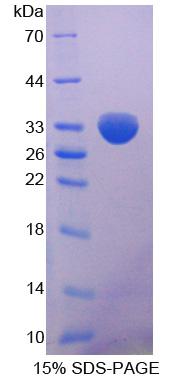 Recombinant Methylthioadenosine Phosphorylase (MTAP)