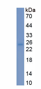 Recombinant Somatostatin Receptor 2 (SSTR2)
