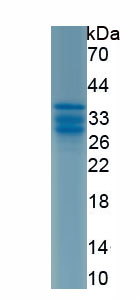 Recombinant Purinergic Receptor P2X, Ligand Gated Ion Channel 7 (P2RX7)