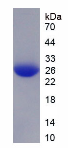 Recombinant Asparaginyl tRNA Synthetase 2, Mitochondrial (NARS2)