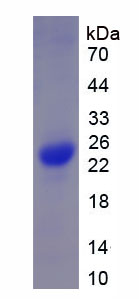 Recombinant Advillin (AVIL)