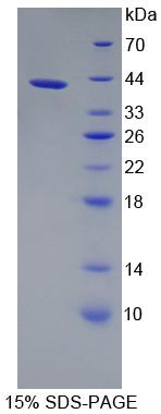 Recombinant Oxoglutarate Dehydrogenase (OGDH)