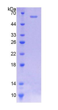 Recombinant N-Acetyltransferase 2 (NAT2)