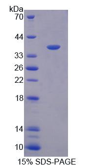 Recombinant Oxidative Stress Induced Growth Inhibitor 1 (OSGIN1)