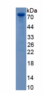 Recombinant Forkhead Box Protein K2 (FOXK2)