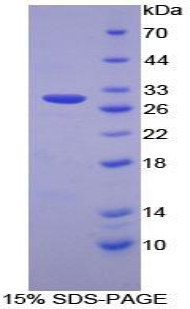 Recombinant Proteasome 26S Subunit, Non ATPase 2 (PSMD2)