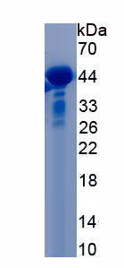 Recombinant Absent In Melanoma 2 (AIM2)