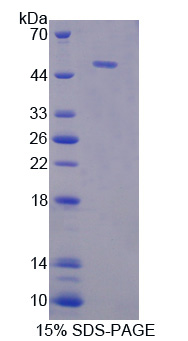 Recombinant Phosphoglycerate Kinase 1 (PGK1)
