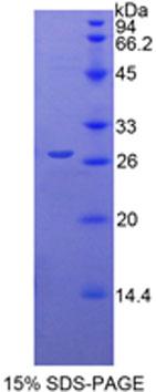 Recombinant Cysteine Rich Protein, Angiogenic Inducer 61 (CYR61)