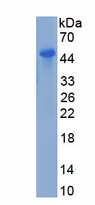 Recombinant Cysteine Rich Protein, Angiogenic Inducer 61 (CYR61)