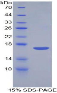 Recombinant Corin (CRN)