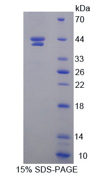 Recombinant Hypoxia Inducible Factor 1 Alpha Subunit Inhibitor (HIF1aN)