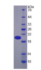 Recombinant Pregnancy Zone Protein (PZP)