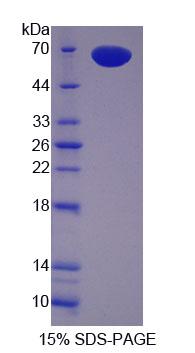 Recombinant Pregnancy Zone Protein (PZP)