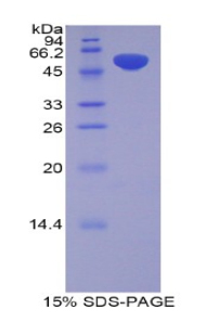 Recombinant Pregnancy Zone Protein (PZP)