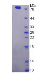 Recombinant ATPase, Ca++ Transporting, Plasma Membrane 2 (ATP2B2)