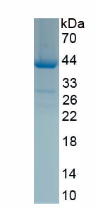 Recombinant ATPase, Cu++ Transporting Beta Polypeptide (ATP7b)