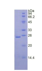 Recombinant Desmocollin 1 (DSC1)