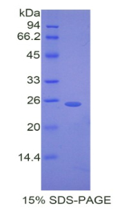 Recombinant Desmocollin 1 (DSC1)