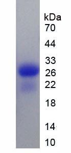 Recombinant Calbindin (CALB)