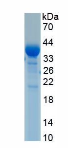 Recombinant 5'-Nucleotidase, Cytosolic IB (NT5C1B)