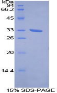 Recombinant Receptor Tyrosine Kinase Like Orphan Receptor 1 (ROR1)