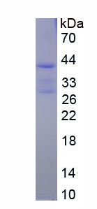 Recombinant TYRO Protein Tyrosine Kinase Binding Protein (TYROBP)