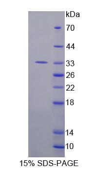 Recombinant Dual Serine/Threonine And Tyrosine Protein Kinase (DSTYK)