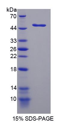 Recombinant Lysophosphatidylcholine Acyltransferase 1 (LPCAT1)