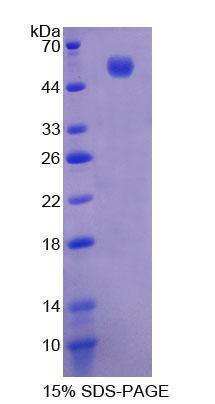 Recombinant Lysophosphatidylcholine Acyltransferase 1 (LPCAT1)