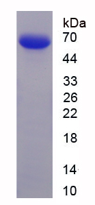Recombinant Lysophosphatidylcholine Acyltransferase 2 (LPCAT2)
