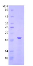 Recombinant Lysophosphatidylcholine Acyltransferase 3 (LPCAT3)