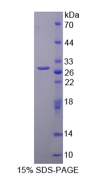 Recombinant Phosphoprotein Associated With Glycosphingolipid Microdomains 1 (PAG1)
