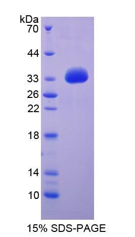 Recombinant Fatty Acid Transport Protein 1 (FATP1)