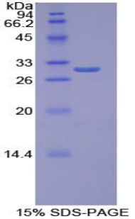 Recombinant Torsin 1B (TOR1B)