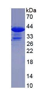 Recombinant Lens Epithelium Derived Growth Factor (LEDGF)