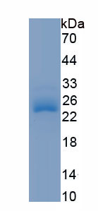 Recombinant Lens Epithelium Derived Growth Factor (LEDGF)