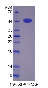 Recombinant Myopalladin (MYPN)