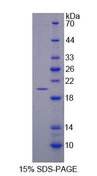 Recombinant GA Binding Protein Transcription Factor Alpha (GABPa)