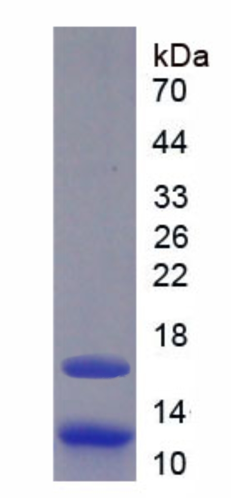 Recombinant NK3 Homeobox Protein 1 (NKX3-1)