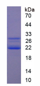 Recombinant Cold Inducible RNA Binding Protein (CIRBP)