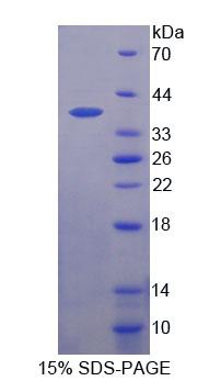 Recombinant Ankyrin Repeat Domain Protein 1 (ANKRD1)